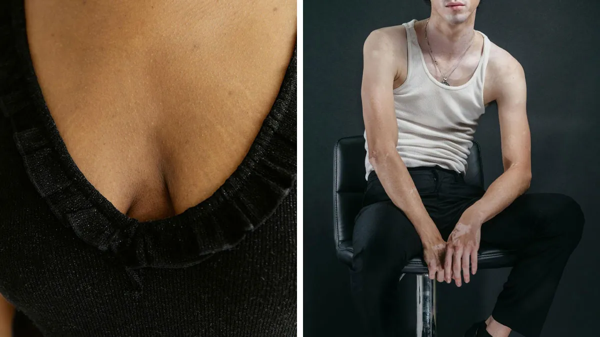 "Hip Dips!": 30 Conventionally Unattractive Features That These People Find Beautiful