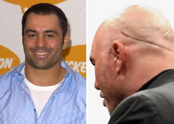 Joe Rogan