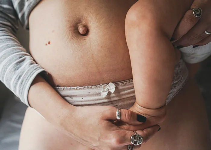 Close-up of a woman holding a baby, highlighting postpartum body changes, with a focus on the belly area.