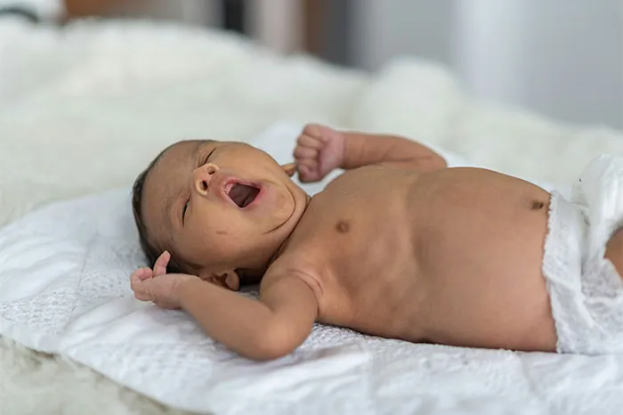 Yawning baby lying on a soft blanket, embodying unforgettable coincidences and serene moments.