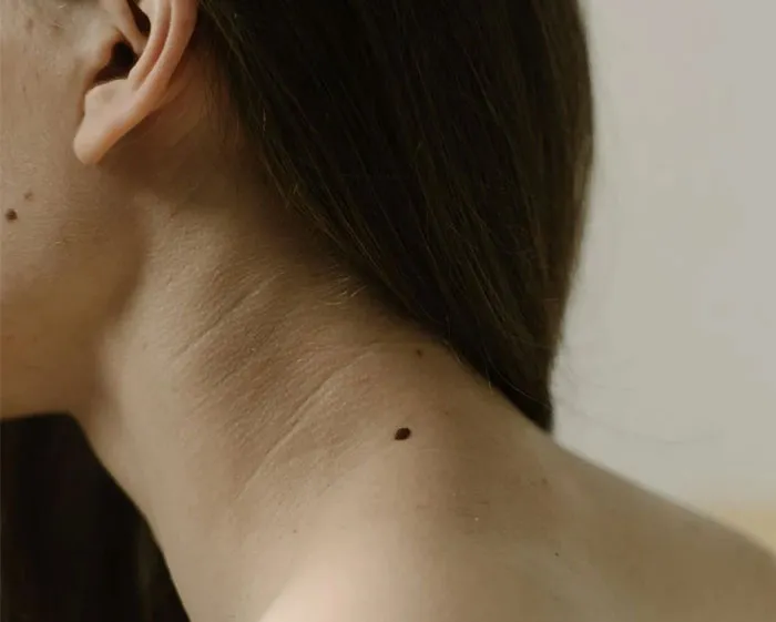Mujer con un lunar visible en el cuello, iluminada sutilmente.