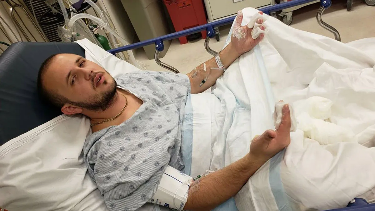 Man Suffers “Life-Changing” Burns At Starbucks Drive-Thru, Settles For $50M
