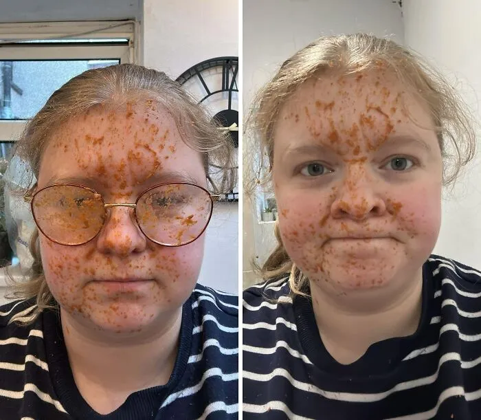 Me ha explotado una lata de salsa de curry en la cara