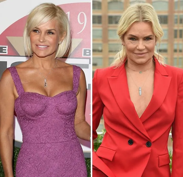 Yolanda Hadid