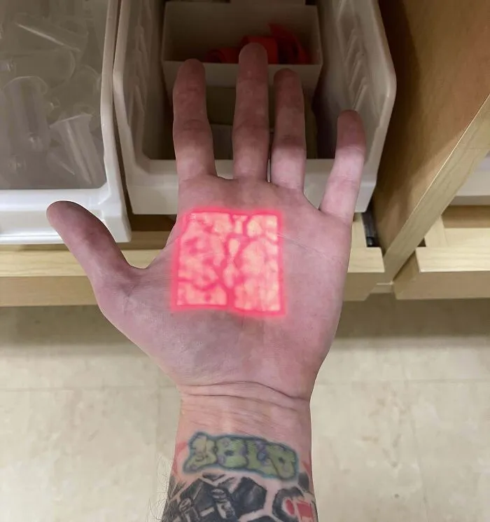 I Recently Started Working In An Er At A Hospital. This Vein Finder Is The Coolest Piece Of Tech Equipment I’ve Come Across