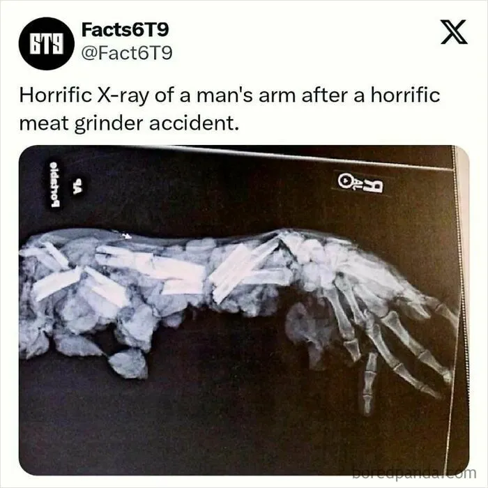 30 Surprising Random Facts You Didn’t Know You Needed, Shared On This IG Page