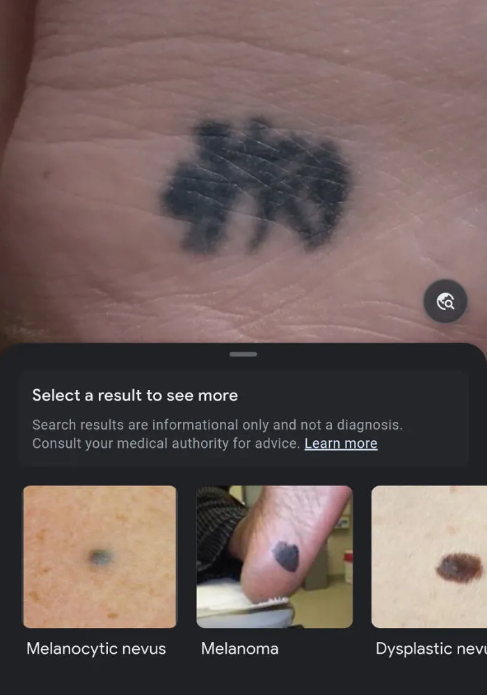 I Ran My Heel Tattoo Through Google Lens Thinking It Would Translate The Thai Character It's Supposed To Be