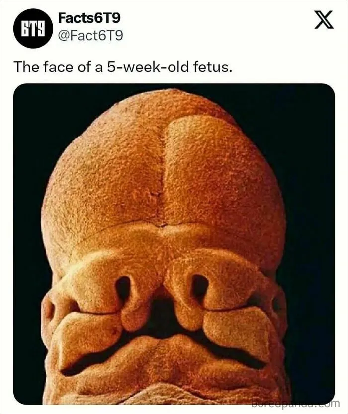30 Surprising Random Facts You Didn’t Know You Needed, Shared On This IG Page