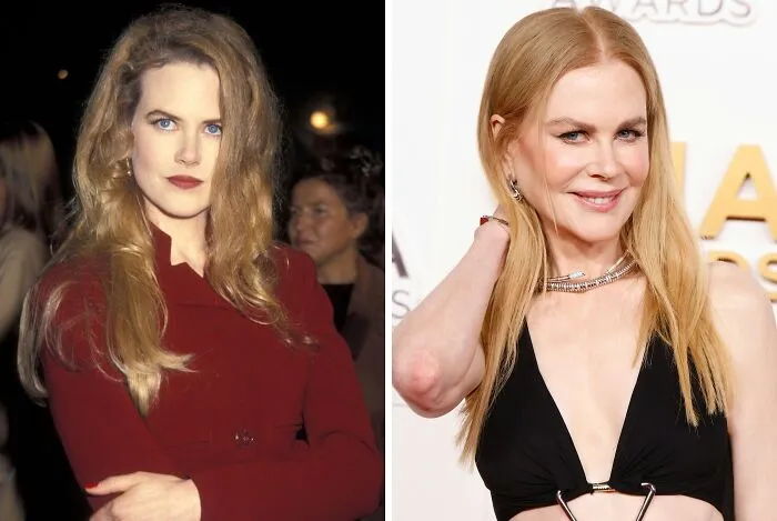 Nicole Kidman