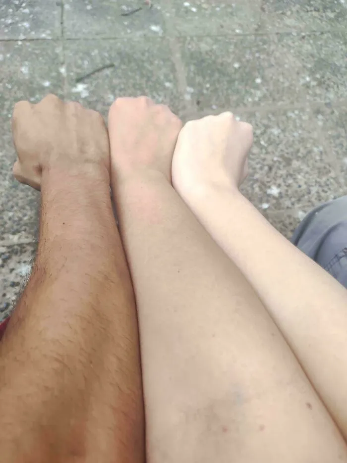 My Siblings And I Have Different Skin Tones
