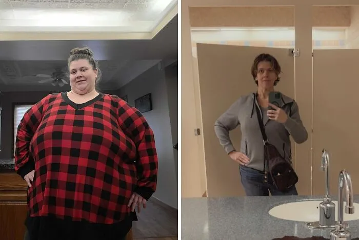 Si no te decides a operarte, yo me hice el cruce duodenal y he perdido un total de 174 kilos