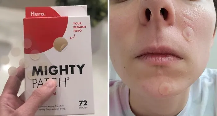 That Surprise Wednesday Blemish Trying To Steal Your Already Dwindling Thunder Can Officially Get Lost, Because These <a Style="Display:inline;" Href="Https://Www.amazon.com/Mighty-Patchtm-Original-Patch-Hydrocolloid/Dp/B0dnr8rf83?ie=utf8&th=1&linkcode=ll1&tag=bporange-20&linkid=711a494c5f868ddb3e1e1599694bd051&language=en_us&ref_=as_li_ss_tl" Target="_blank"><span Style="Font: Inherit; Color: #d74b1f;"> Mighty Patch Pimple Patches </Span> Are Basically Tiny, Discreet Eviction Notices For Your Pores