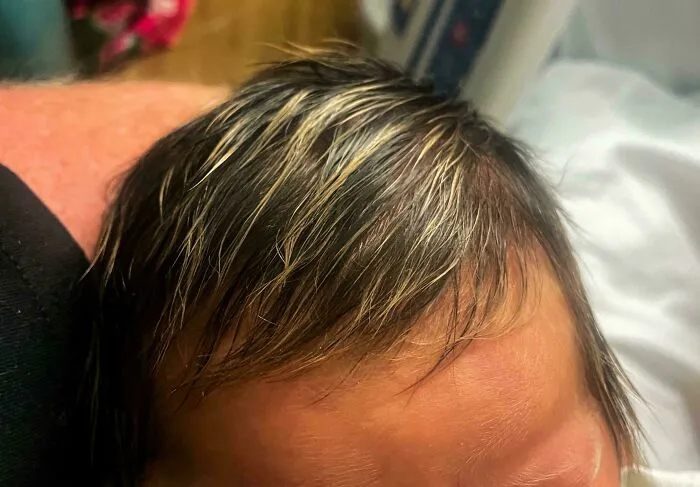 Bebe recién nacido con cabello que presenta una coincidencia increíble de color claro y oscuro en mechones.