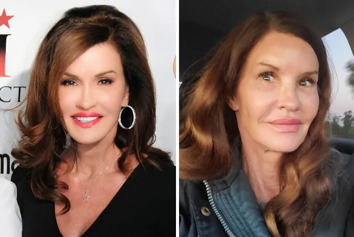 Janice Dickinson