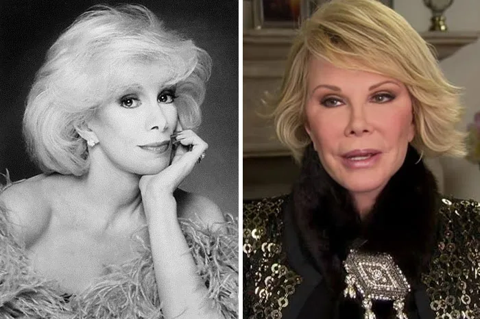 Joan Rivers