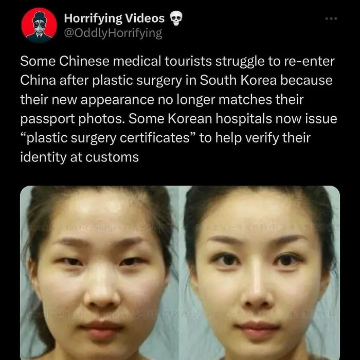 Before and after images of a woman's face post-plastic surgery, highlighting unnerving changes causing passport issues.