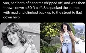 “Oddly Horrifying”: 50 Of The Most Unnerving Images That Might Freak You Out