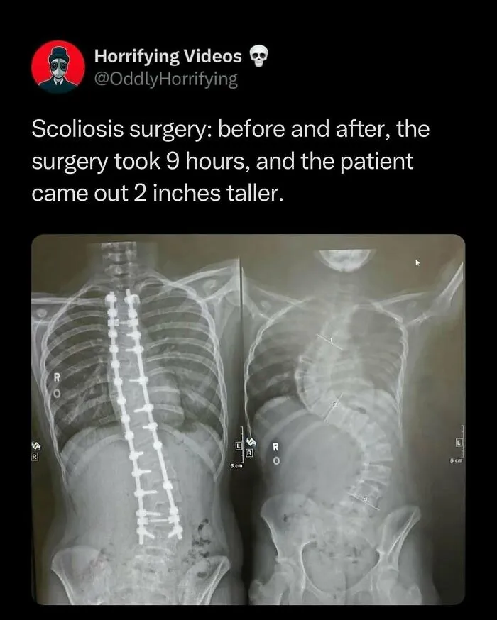 “Oddly Horrifying”: 50 Of The Most Unnerving Images That Might Freak You Out