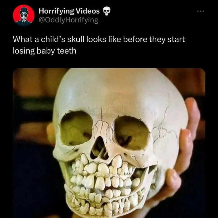 A child's skull before losing baby teeth, unnerving image held in hand.