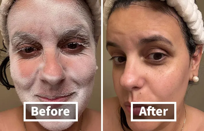 The Struggle To See Those Pesky Stray Hairs While Shaving Is Real, But The Clever <a Style="Display:inline;" Href="Https://Www.amazon.com/Identifier-Shaving-Dermaplaning-Shavers-Suitable/Dp/B0d8t6t95l?ie=utf8&th=1&linkcode=ll1&tag=bpsparrow-20&linkid=5eaf284750fb04919146addf3a4039c5&language=en_us&ref_=as_li_ss_tl" Target="_blank"> <span Style="Font: Inherit; Color: #d74b1f;"> Hair Identifier Spray For Face Shaving </Span> Helps To Highlight Even The Smallest Hairs, Making It Easier To Get A Smooth And Precise Shave Every Time