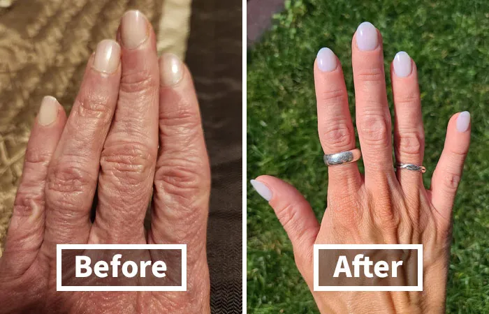 Dull, Faded Nails Can Make Your Hands Look Older And Worn Out, But The Ingenious <a Style="Display:inline;" Href="Https://Www.amazon.com/Londontown-Illuminating-Nail-Concealer-12ml/Dp/B07v2yny3n?ie=utf8&th=1&linkcode=ll1&tag=bpsparrow-20&linkid=c4b7998de4350ef0d6e517f7f7c6ad7a&language=en_us&ref_=as_li_ss_tl" Target="_blank"> <span Style="Font: Inherit; Color: #d74b1f;"> Londontown Kur Illuminating Nail Concealer </Span> Helps To Brighten And Whiten The Nail Area, Giving Your Hands A Youthful And Radiant Appearance