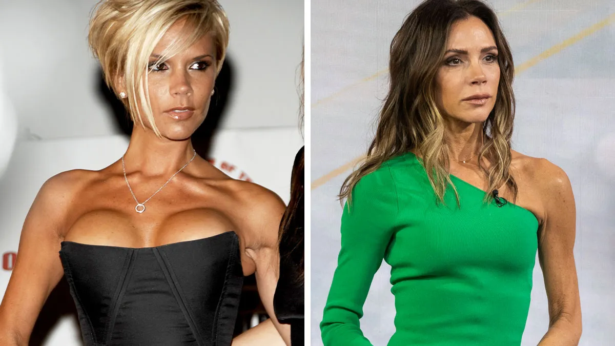These 20 Celebs Had Their Breast Implants Removed—Before And After Photos Revealed