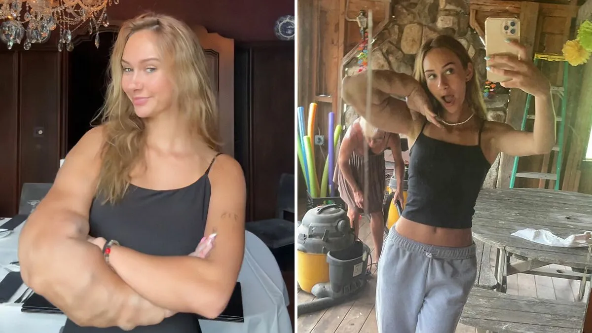 "I Always Explain": Woman With One Arm Larger Than The Other Reveals Her Response To Stares
