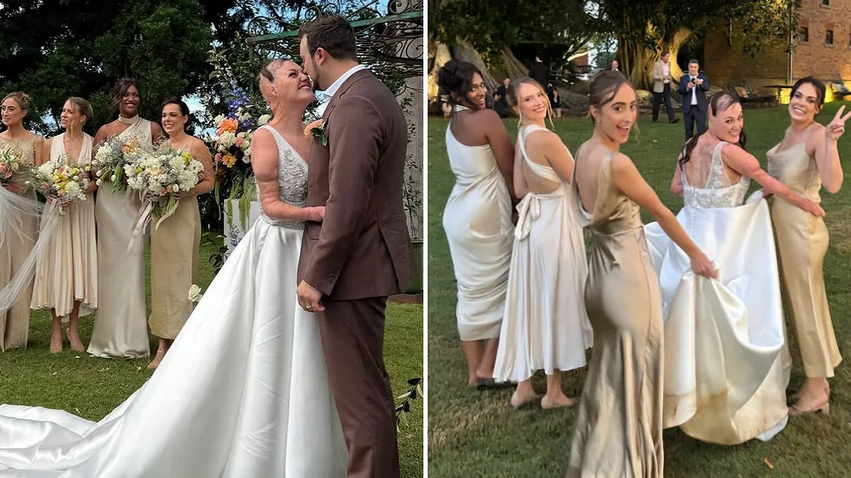 Miracle Burns Survivor Dubbed "Australia's Bravest Girl" Ties The Knot In Heartwarming Ceremony