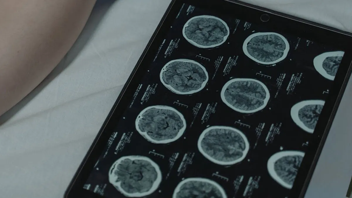 30 Doctors Share The Weirdest And Most Disgusting Things Found In People’s Bodies