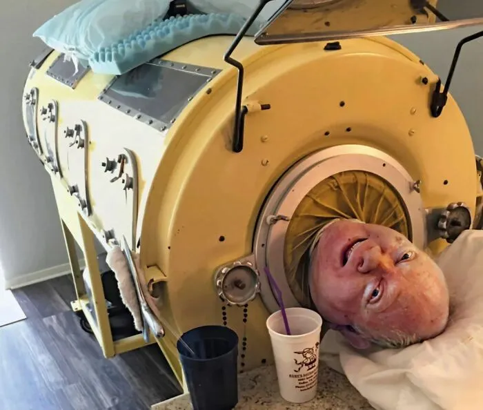 Man in an iron lung with a yellow exterior, part of fascinating stories from around the world.