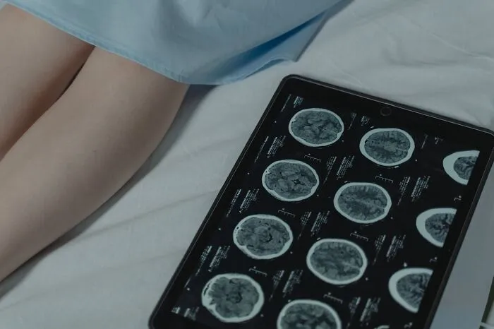 30 Doctors Share The Weirdest And Most Disgusting Things Found In People’s Bodies