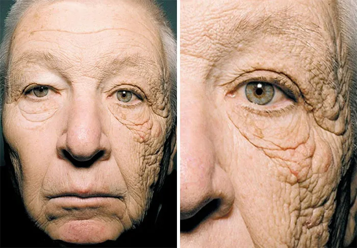 50 Medical Pics That Prove The Body Keeps The Score, And Sometimes It’s Absolutely Terrifying