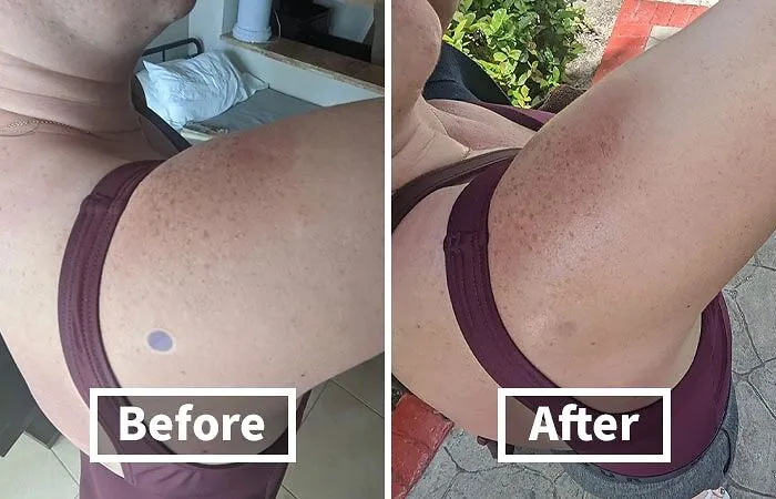 You'll Actually Know When To Reapply Your SPF, Instead Of Just Vaguely Hoping For The Best, Thanks To These Genius Little <a Style="Display:inline;" Href="Https://Www.amazon.com/Spotmyuv-Stickers-Sunscreen-Dermatrue-Technology/Dp/B08x6b2t43?ie=utf8&th=1&linkcode=ll1&tag=bpshark-20&linkid=744f35e5a1ff4625ca097fd3133a1085&language=en_us&ref_=as_li_ss_tl" Target="_blank"><span Style="Font: Inherit; Color: #d74b1f;"> UV Detection Stickers </Span>