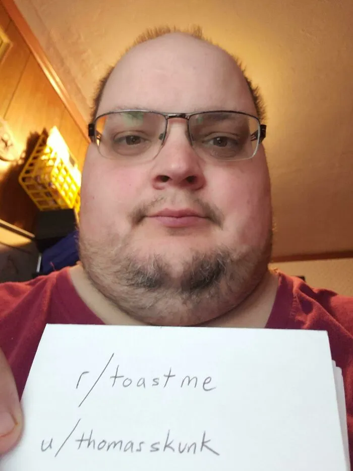 Diagnosed With Borderline Personality Disorder And Ptsd From Both Being Raped In 2001. Suffered Severe Verbal And Mental Abuse From 2011-2013 From Roommates. I Gained A Lot Of Weight From Trying To Eat Away My Issues, But Since 2016, I've Lost 105 Lbs. Starting To Get My Life Together