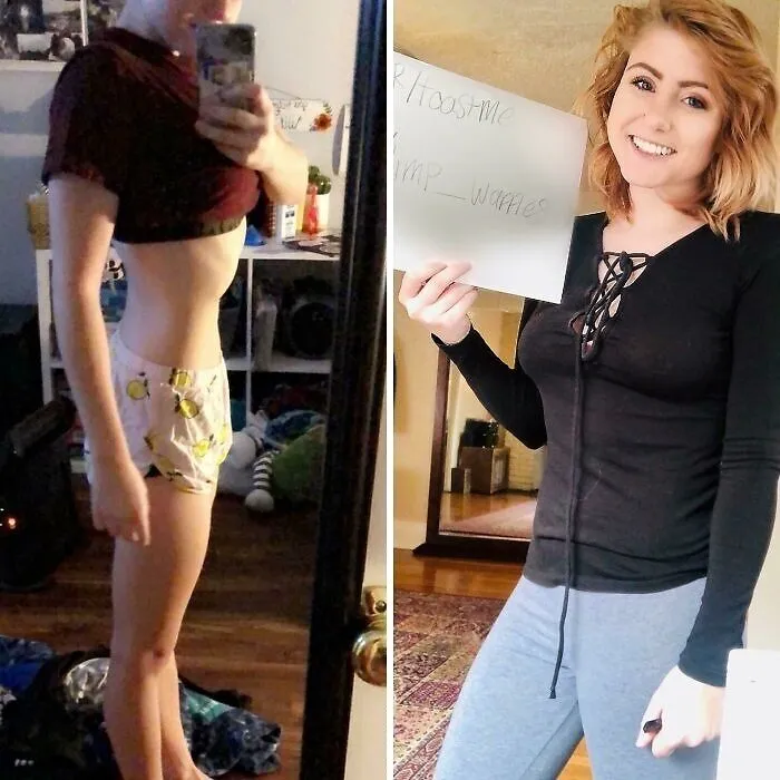 A Year Ago I Was In The Hospital For My Anorexia. I Was In A Wheelchair, Unable To Walk And Almost Was Being Fed Through A Tube. Today I Am 10 Lbs Heavier, Eating Daily And Finally Able To Work Out Again Without Passing Out Every Time. It Is Still Such A Struggle Everyday Positive Words Will Help!