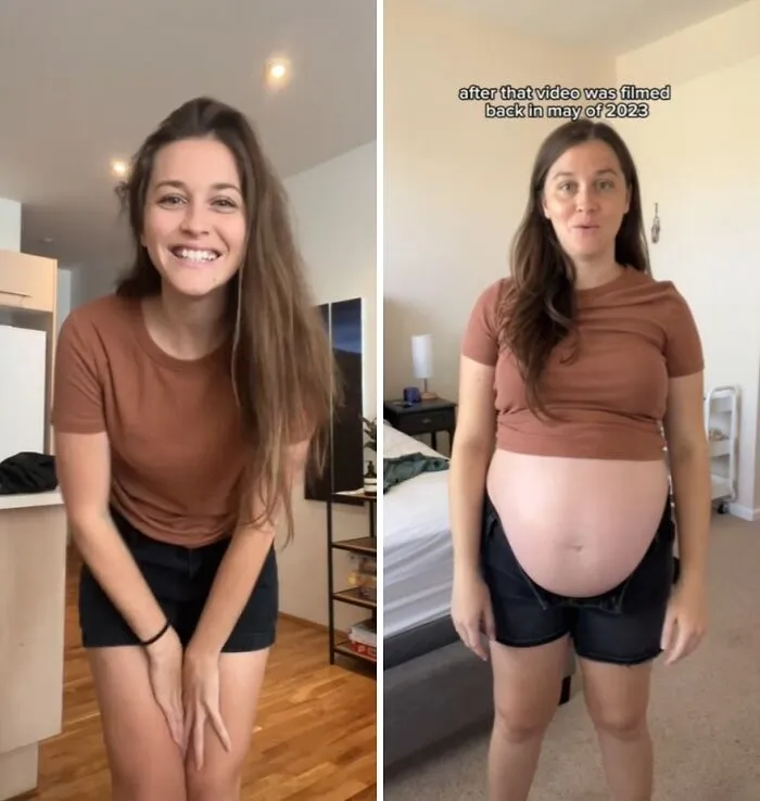 Women Are Sharing What They Looked Like Before Getting Pregnant To Highlight Extreme Changes