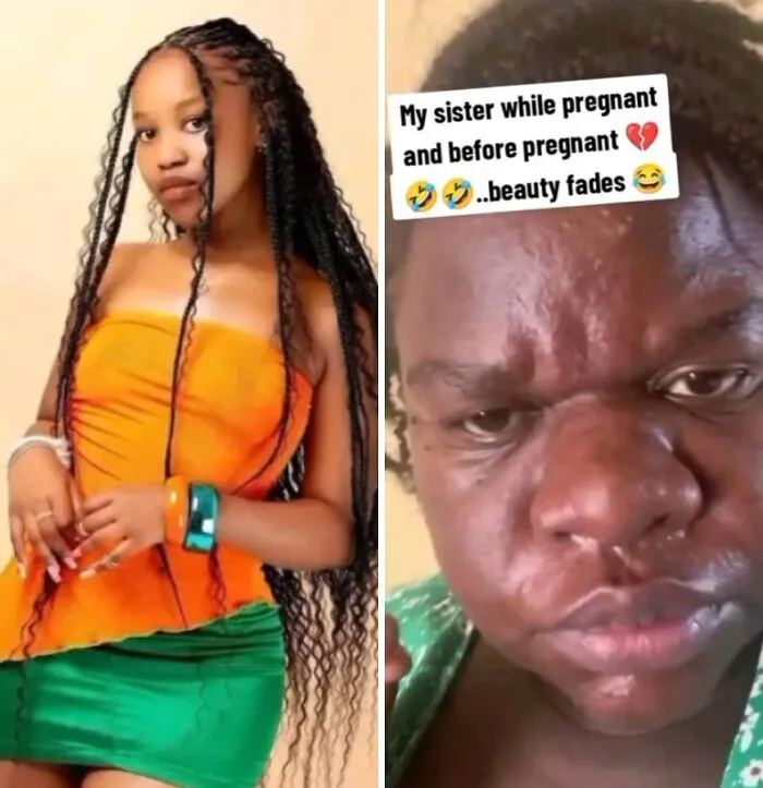Women Are Sharing What They Looked Like Before Getting Pregnant To Highlight Extreme Changes