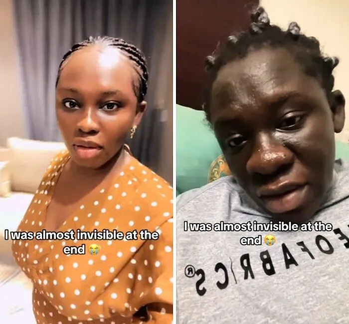 Women Are Sharing What They Looked Like Before Getting Pregnant To Highlight Extreme Changes