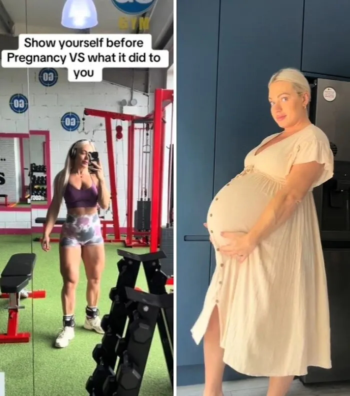 Women Are Sharing What They Looked Like Before Getting Pregnant To Highlight Extreme Changes