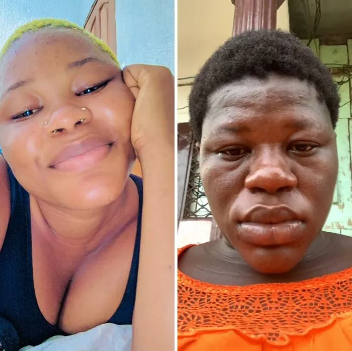 Women Are Sharing What They Looked Like Before Getting Pregnant To Highlight Extreme Changes