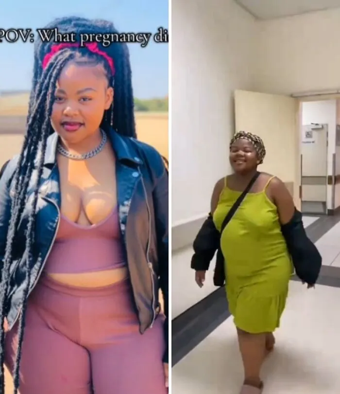 Women Are Sharing What They Looked Like Before Getting Pregnant To Highlight Extreme Changes