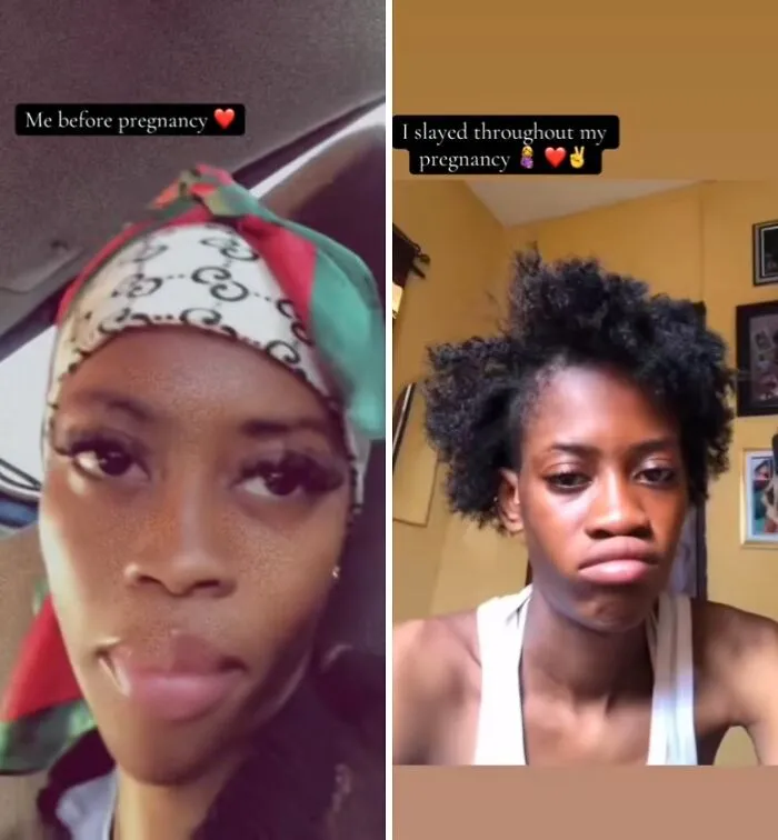 Women Are Sharing What They Looked Like Before Getting Pregnant To Highlight Extreme Changes