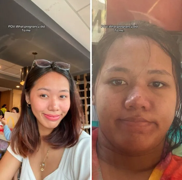 Women Are Sharing What They Looked Like Before Getting Pregnant To Highlight Extreme Changes