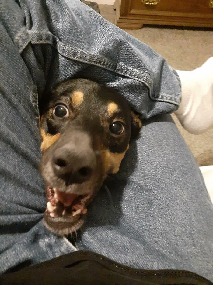 Every Time I Go To Put My Ankle On My Knee To Put On Shoes, This Happens