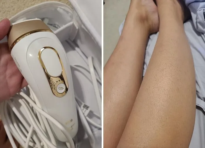 Your Journey To Smoother Skin, Minus The Endless Shaving Or Waxing Appointments, Can Start Right In Your Bathroom With A <a Style="Display:inline;" Href="Https://Www.amazon.com/Braun-Removal-Long-Lasting-Reduction-Regrowth/Dp/B07wyy6kkc?ie=utf8&linkcode=ll1&tag=bprhinoceros-20&linkid=5e463f32af416e1cf07cacec24db39ea&language=en_us&ref_=as_li_ss_tl" Target="_blank"><span Style="Font: Inherit; Color: #d74b1f;"> Braun Ipl At Home Laser Hair Removal </Span> Device