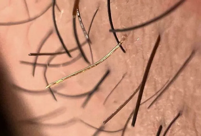 Tengo un solo pelo dorado en mi cara