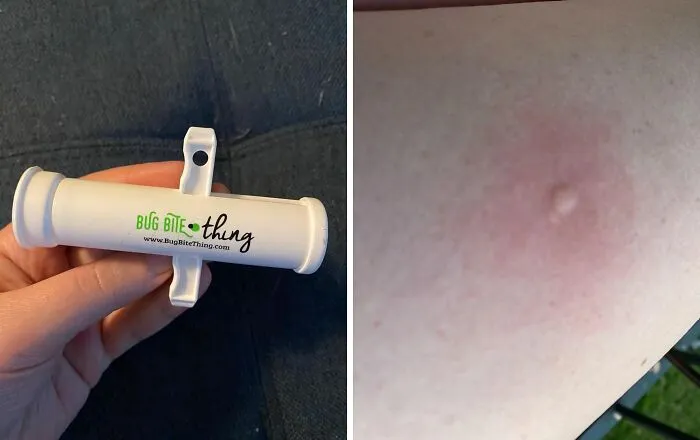 That Mosquito Who Thought Your Picnic Was An All-You-Can-Eat Buffet Is About To Be Very Disappointed When You Whip Out <a Style="Display:inline;" Href="Https://Www.amazon.com/Bug-Bite-Thing-Suction-Remover/Dp/B01576dwqu?ie=utf8&th=1&linkcode=ll1&tag=bpraccoon-20&linkid=62454110d4722352d5c3d1bbd3b6d245&language=en_us&ref_=as_li_ss_tl" Target="_blank"><span Style="Font: Inherit; Color: #d74b1f;"> This Bug Bite Thing Suction Tool</Span> To Minimize The Itch And The Drama