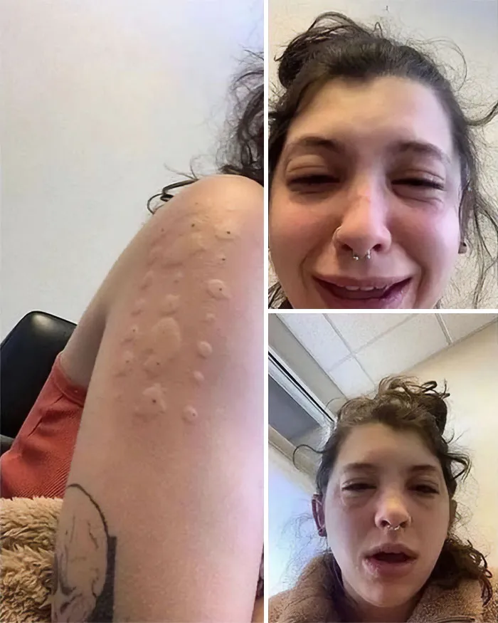 38 Fotos médicas que demuestran que el cuerpo es a veces aterrador