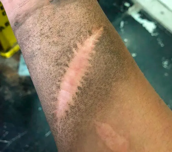 38 Fotos médicas que demuestran que el cuerpo es a veces aterrador