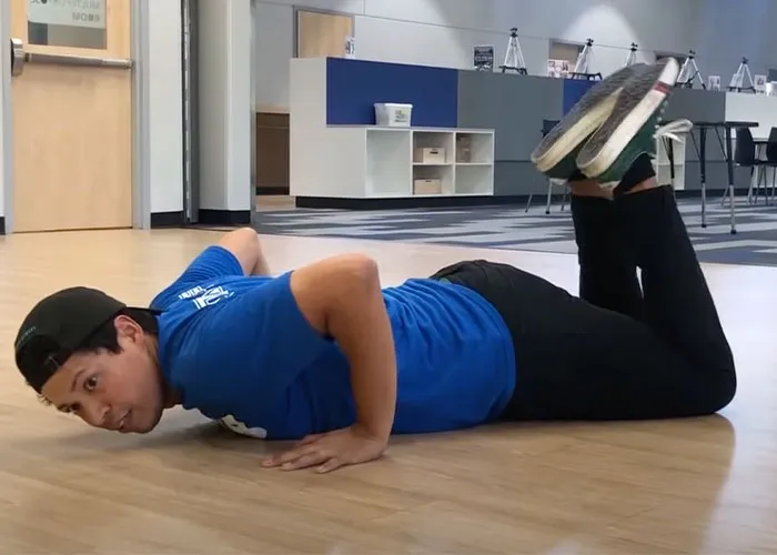 50 People Share Their Injuries That Are Not Funny But You Can’t Help But Laugh